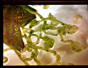 Bacteria Growing Lace